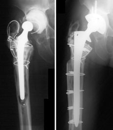 knee parts of of Department Orthopaedics and Traumatology, The